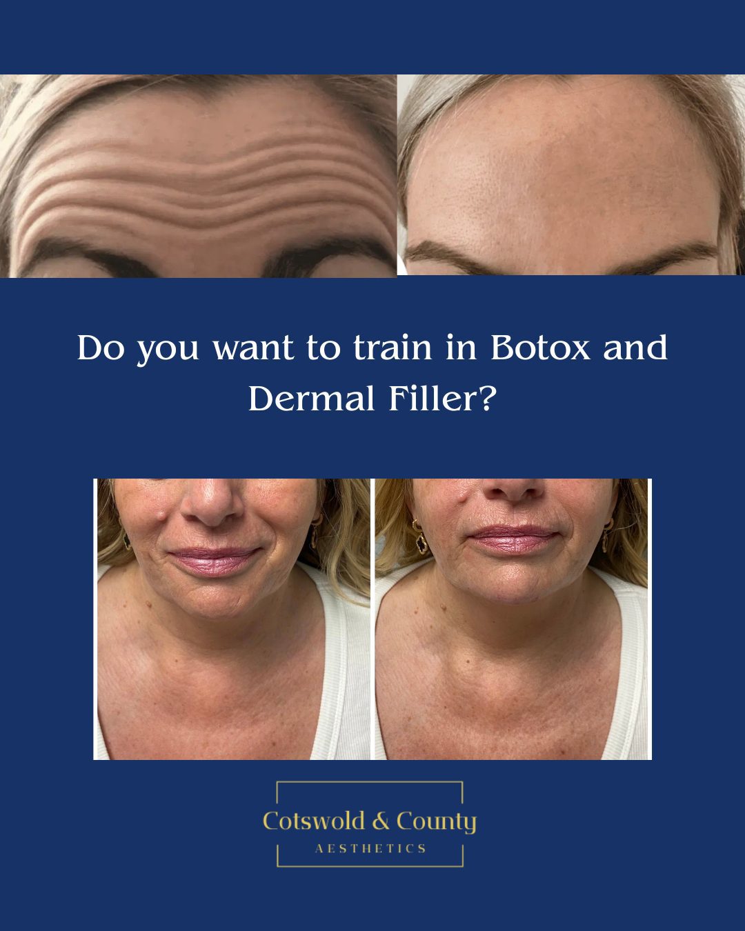 Do you want to train